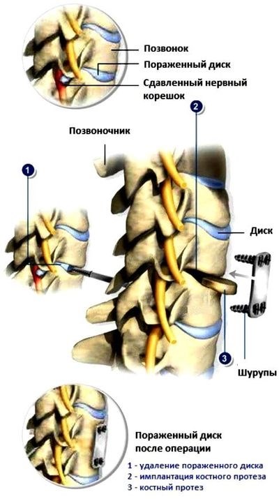 Какой врач лечит боли в пояснице